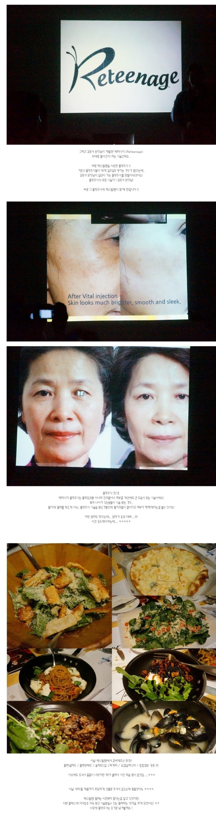 2014년3월27일 레스틸렌 필러, 레티나지 강의후기 - 듬아 관련 이미지 3