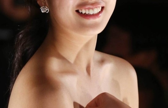 Gangnam Plastic Surgery Wrinkle Removal Surgery / Facelift image 5