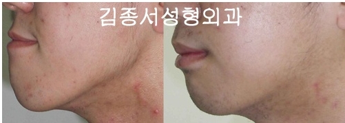 안면윤곽 최우수병원선정 ! 관련 이미지 11