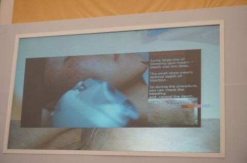 I Went to the Restylane 20 Million Treatment Commemoration Beauty Week image 30