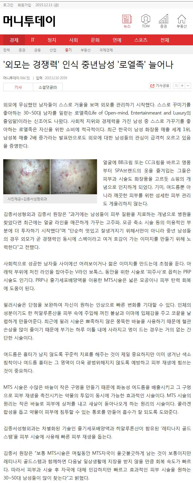 여드름흉터 관리 줄기세포 MTS 시술 관련 이미지 1