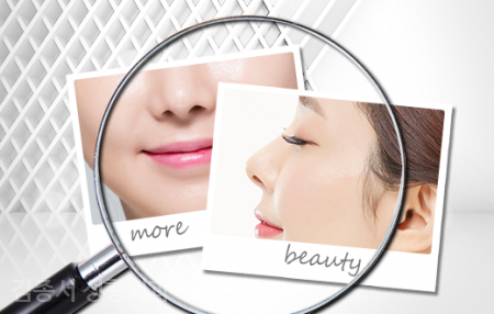 ◆Information Sharing◆ Rhinoplasty image 6