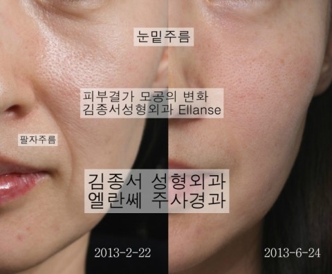 놀랍도다 쁘띠성형 관련 이미지 3