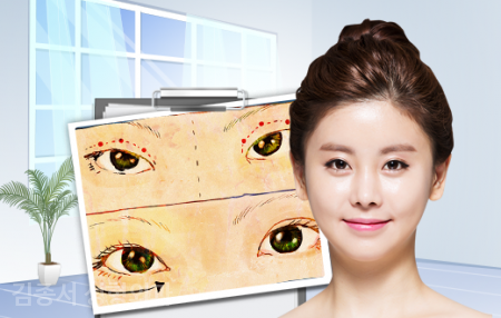 함께 알아봅시다! 눈성형 관련 이미지 2