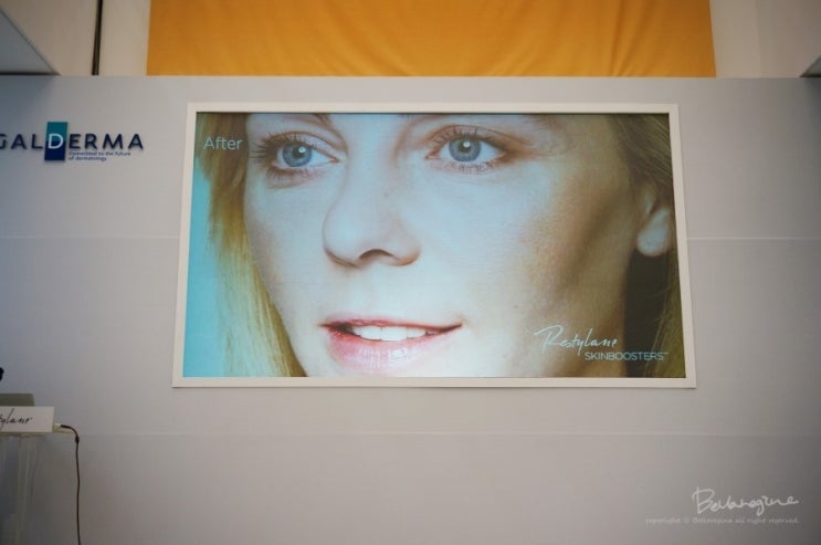 I Went to the Restylane 20 Million Celebration Event at Beyond Museum in Cheongdam-dong. image 6