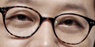 관상성형 김종서성형외과 관련 이미지 2