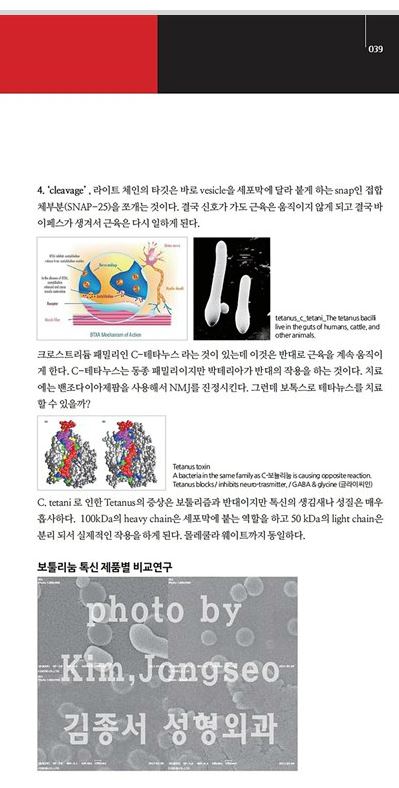 메디컬S 잡지 기사/ 보톡스 / 김종서성형외과원장 (디스포트,보톡스,주름,사각턱보톡스,종아리보톡스,승모근) 관련 이미지 7