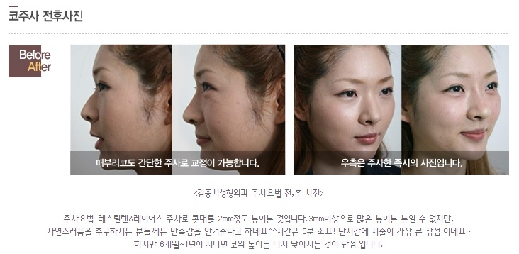 뷰티타임에 김종서성형외과가 소개되었어요♡ 관련 이미지 4