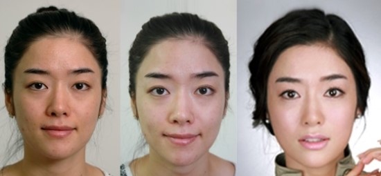 레스틸렌 물광주사 추천 관련 이미지 1