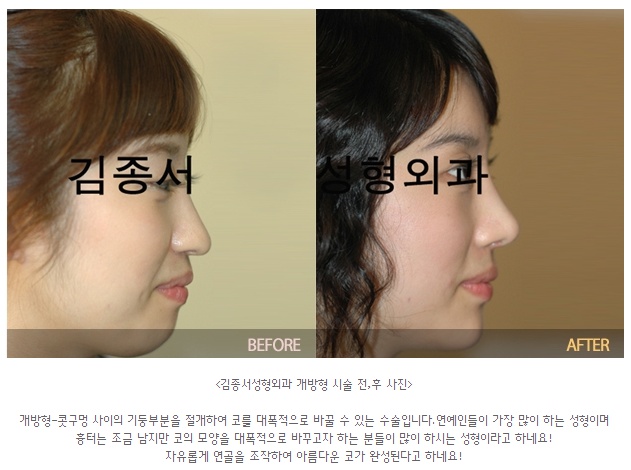 뷰티타임에 김종서성형외과가 소개되었어요♡ 관련 이미지 6