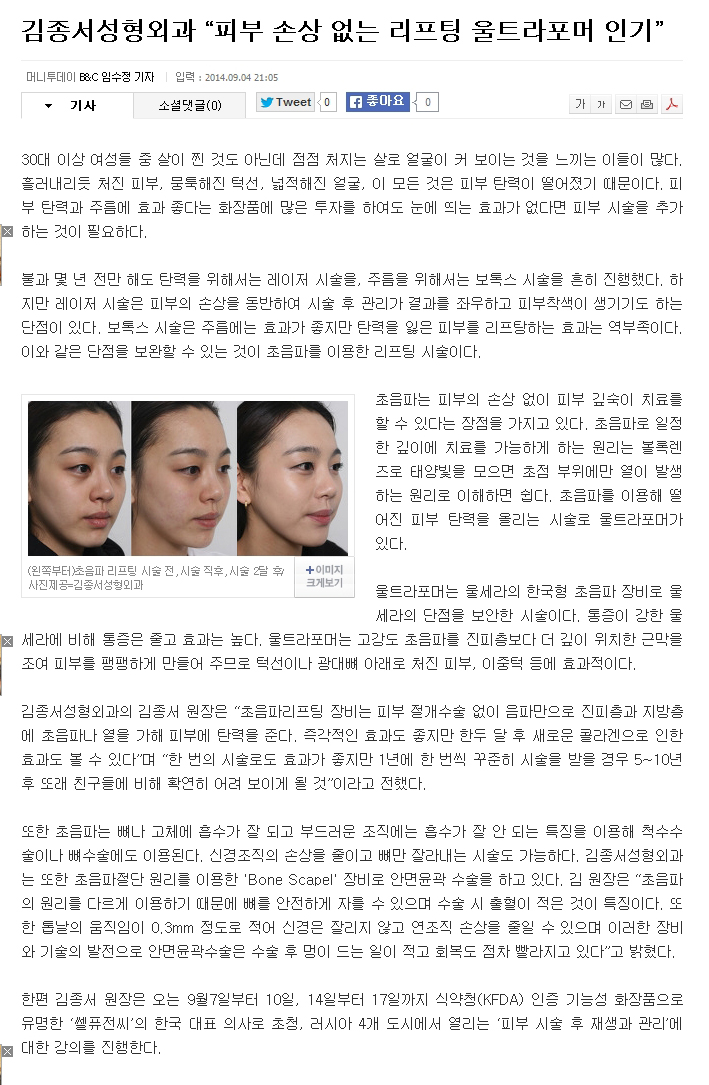 Kim Jong-seo Plastic Surgery “Ultraformer Popular for Lifting Without Skin Damage” image 1