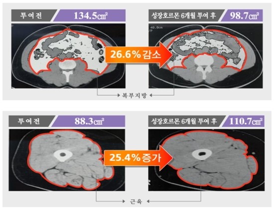 [성장호르몬효과] 성장호르몬은 안티에이징의 가장 기초이며 핵심입니다! 관련 이미지 7