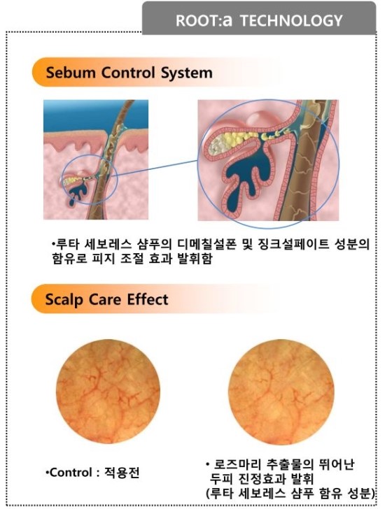 루타샘푸 루타토닉 병원용탈모관리 / 김종서성형외과 / 셀퓨전씨화장품 관련 이미지 5