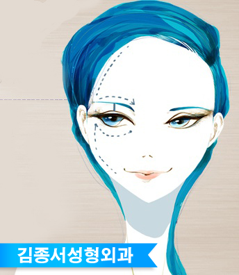 또렷한 눈을 위한 눈성형 - 김종서성형외과 관련 이미지 1