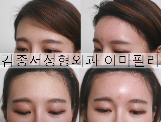 Click! Mini Plastic Surgery image 5