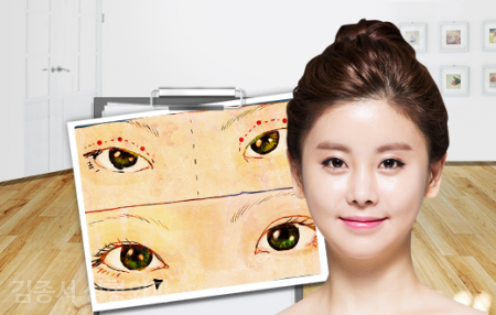 지성인이라면 알아두어야 할 눈성형. 관련 이미지 7