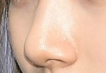 강남코성형 - 코성형 잘하는 곳 관련 이미지 1