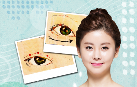 눈성형 지식E 쑥쑥 관련 이미지 4