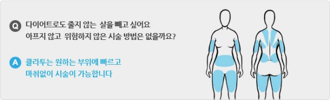클라투/ 냉동지방분해술/ 김종서성형외과 관련 이미지 6