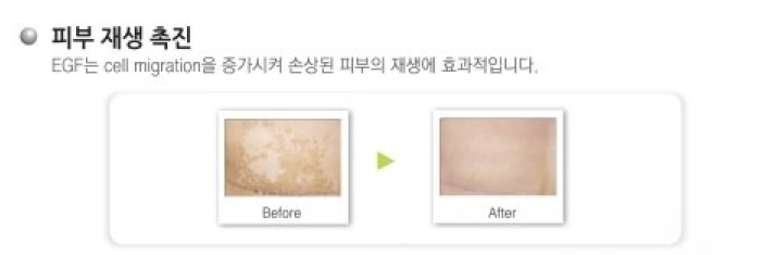 대웅제약의 이지듀화장품 관련 이미지 7