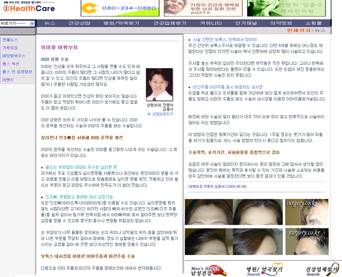 이마 성형 2002년부터 연구발표, 수많은 신문 기사에 ..김종서성형외과/ 봉긋한 이마 /동안이마 관련 이미지 5