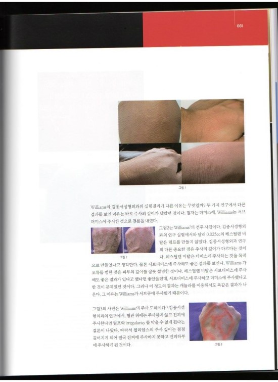 메디컬S 김종서성형외과 인터뷰/레스틸렌 비탈 엄지원필러/주름개선 물광주사 관련 이미지 3