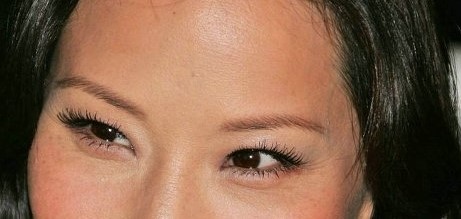 Sinsa-dong Eye Surgery - Speed Buried Suture Method / Double Eyelid Surgery image 4