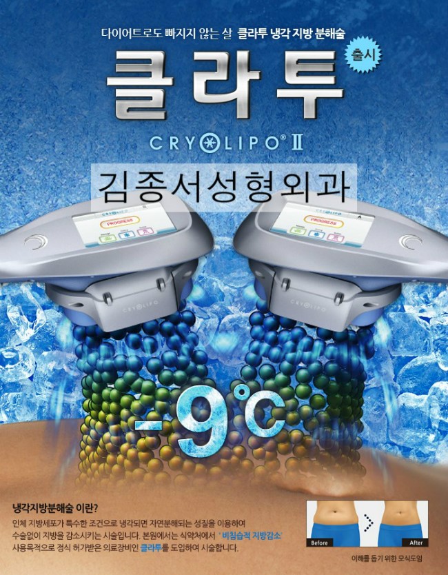 클라투/ 냉동지방분해술/ 김종서성형외과 관련 이미지 3