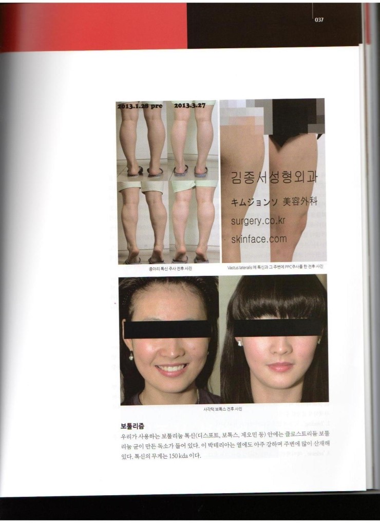 2013년 11월호 Medical에 김종서 원장님 "보툴리눔 톡신별 특징과 적응증"에 대한 기사가 실렸습니다. 관련 이미지 5