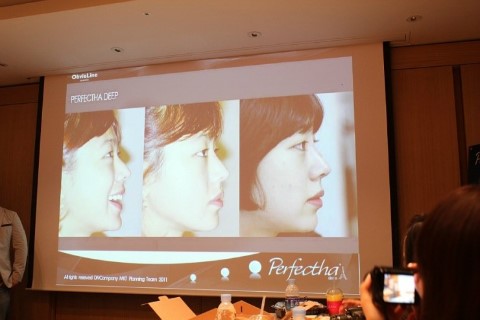 히알루론산필러 퍼펙타 필러 관련 이미지 8
