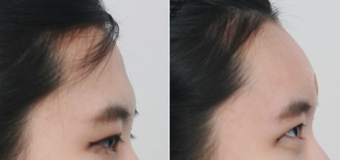 Plastic Surgery, a Collection of Information image 7