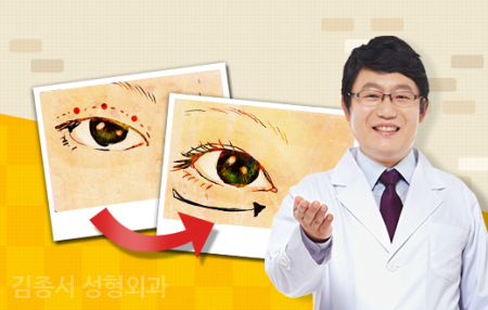 It’s a Hit, Eye Surgery!! image 7