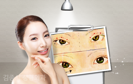 함께 알아봅시다! 눈성형 관련 이미지 6