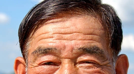 강남울트라포머리프팅- 울트라포머 잘하는곳 관련 이미지 2