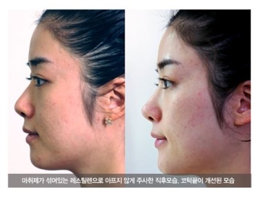 Petit Cosmetic Procedures 알려주는 Just for You image 3