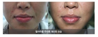 Petit Cosmetic Procedures 알려주는 Just for You image 5