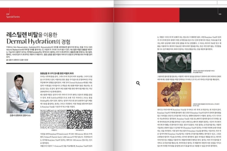 medical S 2013년 9월호 레스틸렌 비탈을 이용한 Dermal Hydration의 경험 관련 이미지 1