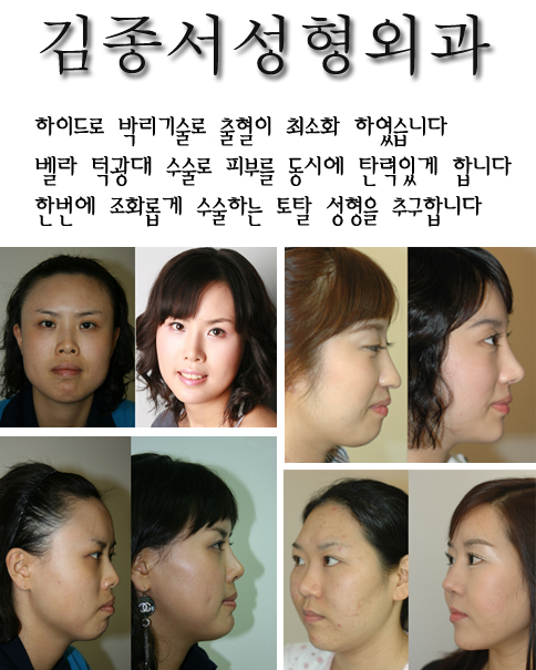 안면윤곽수술 전후사진 관련 이미지 1