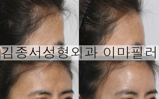 Click! Mini Plastic Surgery image 7