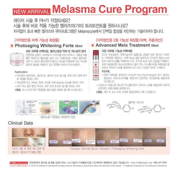 [CMS] 어드벤스 멜라스마 트리트먼트 관련 이미지 1