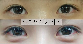 Collecting Knowledge About Eye Surgery! image 13