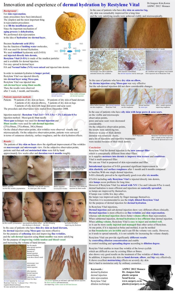 Director Kim Jong-seo, Developer of the Skin Booster Injection, Published in a Journal ^^ image 2