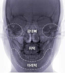 안면윤곽 최우수병원선정 ! 관련 이미지 2