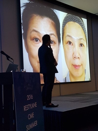 July 2, 2016 Restylane Lecture [2016 Restylane CME Summer] image 4