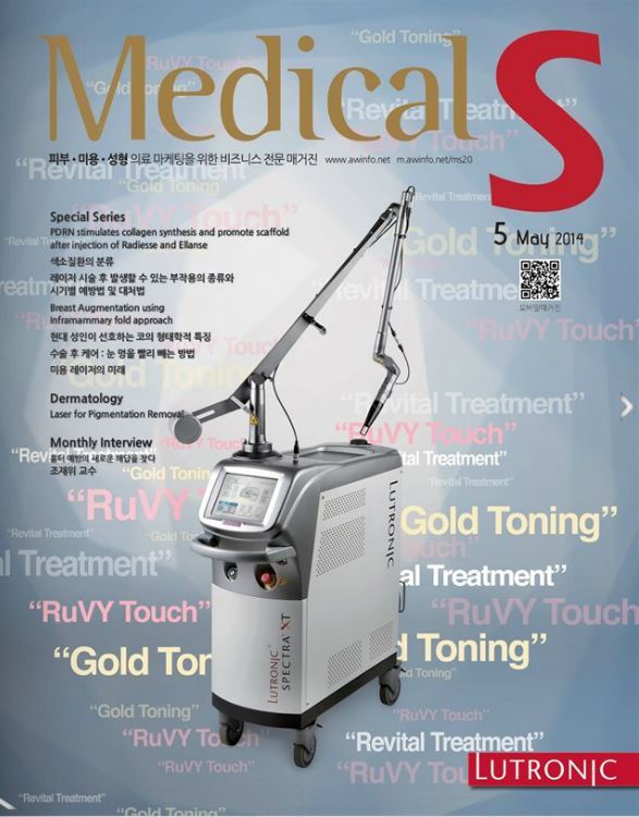 [메디컬S] 메디컬S 5월호 Stimulator 필러제 주사 후 PDRN 주사 비교 연구 관련 이미지 9