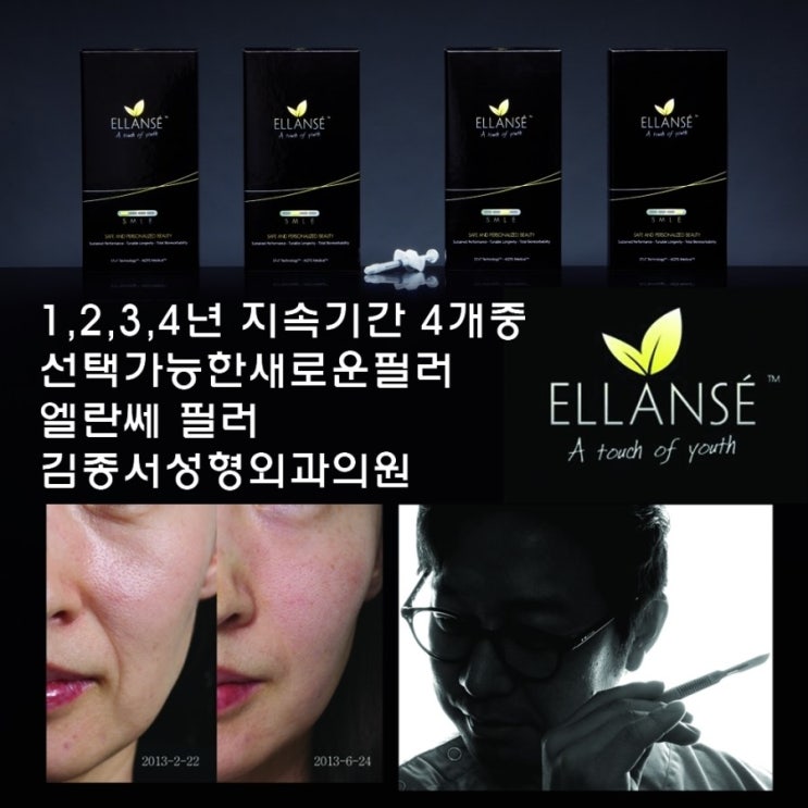 Youthful, natural, and easy to achieve with a full, refreshed look; filled with collagen from within the skin / Kim Jong-seo Plastic Surgery / Filler image 3