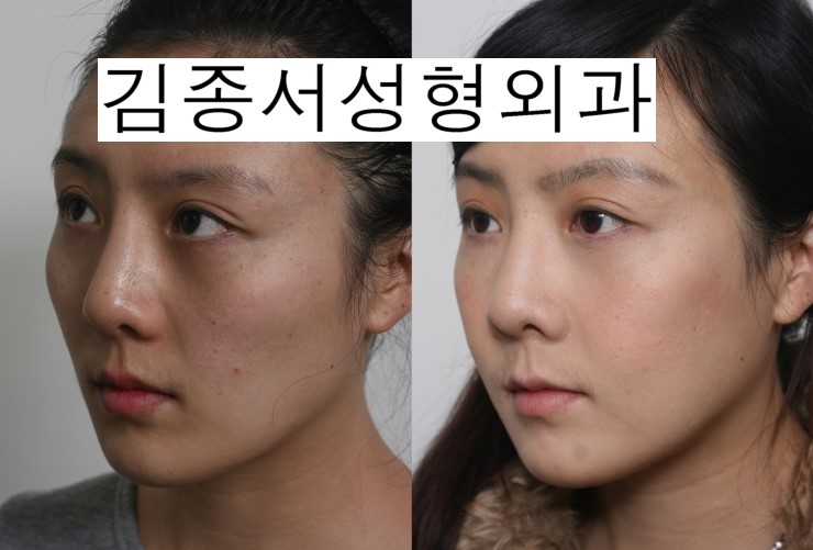 중국분인데요..광대수술을 하시고 한복을 입고 사진을 보내주셨네요 ^^ 관련 이미지 1