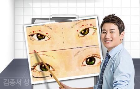 눈성형 필수정보 관련 이미지 3