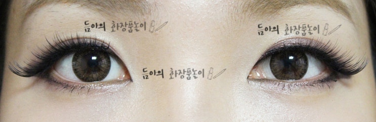 [공유] 성형수술을 결심하게 된 계기. in 김종서 성형외과 관련 이미지 4