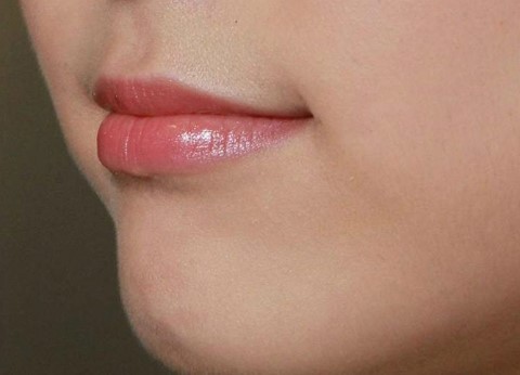 Hydro Injection That Lasts 13 Months image 1